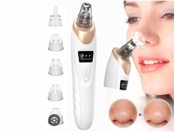 5-in-1 Blackhead Remover Advanced Suction Technology
